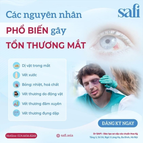 CÁC NGUYÊN NHÂN GÂY RA CHẤN THƯƠNG MẮT