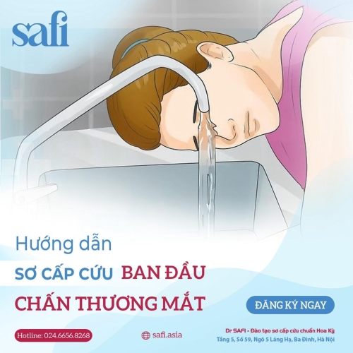 CHẤN THƯƠNG MẮT: HƯỚNG DẪN XỬ LÝ CHẤN THƯƠNG MẮT