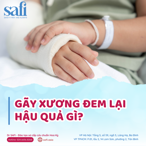 Sơ Cứu Gãy Xương: Nguyên Nhân, Hậu Quả và Cách Sơ Cứu