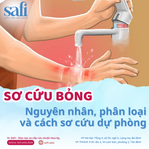 Sơ cứu bỏng: Nguyên nhân, phân loại và cách sơ cứu dự phòng
