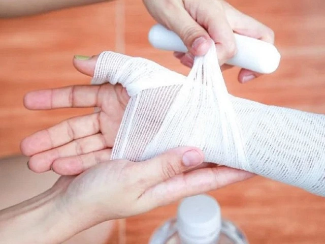 Sơ cứu bỏng: Nguyên nhân, phân loại và cách sơ cứu dự phòng
