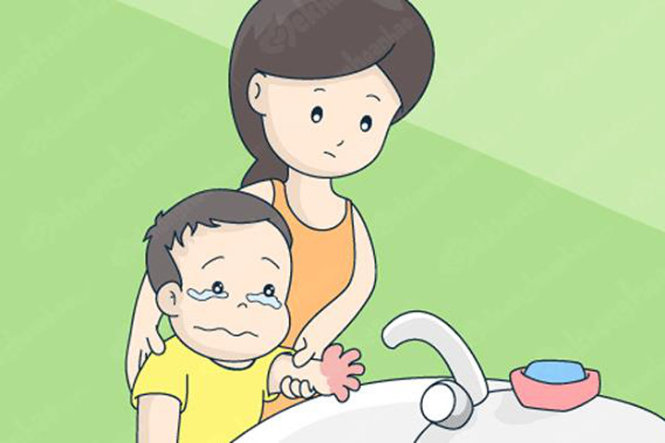 Sơ cứu bỏng: Nguyên nhân, phân loại và cách sơ cứu dự phòng